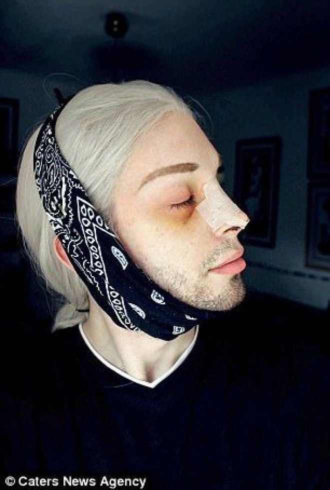 Мужчина потратил 25 000 фунтов чтобы превратиться в эльфа