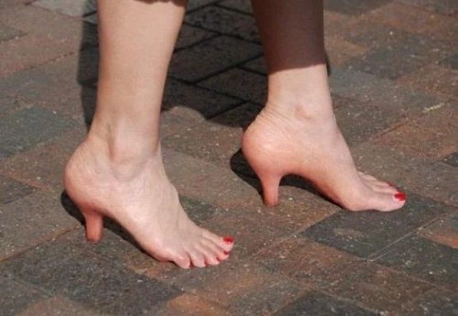 15 мерзких фото которые будут сниться вам в кошмарных снах