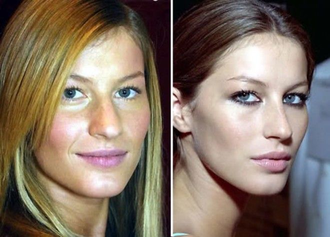 10 знаменитостей которым пластика явно пошла на пользу