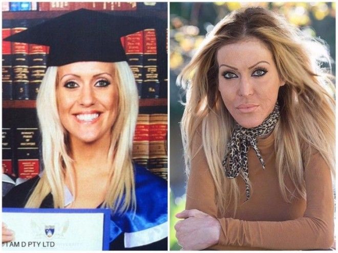 девушки облитые кислотой девушки до и после того как их облили кислотой