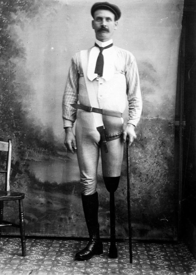 Протезы английского сапожника